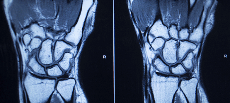 Open MRI